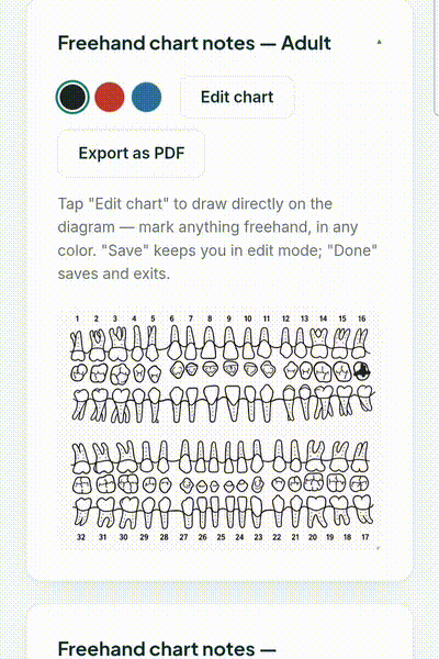 Freehand dental chart: drawing directly on the tooth diagram, then saving